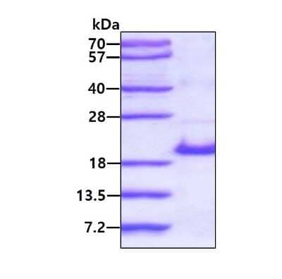 SDS-Page: Recombinant Human RPS14 His Protein [NBP1-51002] - 3ug by SDS-PAGE under reducing condition and visualized by coomassie blue stain.